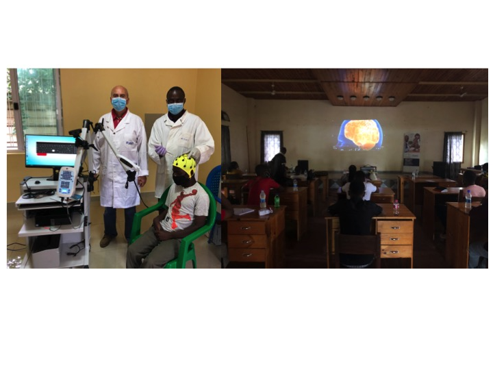 Epilessia in Africa: Sin dona video elettroencefalografo