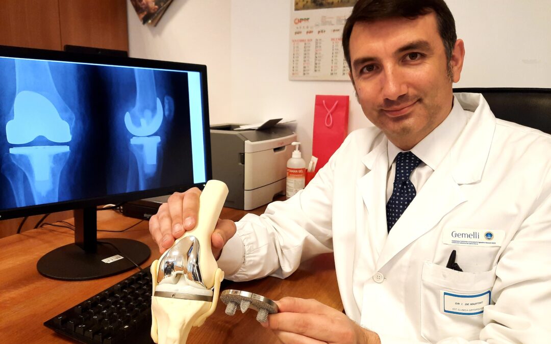 Protesi del ginocchio in titanio… fatta con la stampante 3D