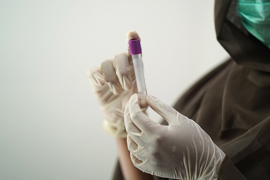 Un nuovo strumento per predire l’evoluzione della leucemia